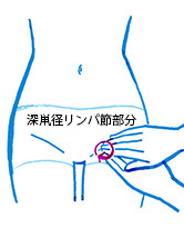 疲労回復のための深鼡径(脚の付け根)のリンパマッサージ